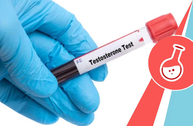 Navigating the Waves of Online Testosterone Purchase - Your Comprehensive Guide