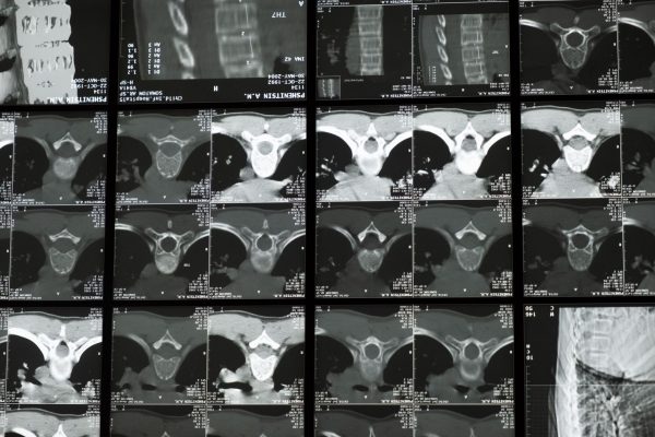 Neutron Bone Imaging: Proven Way to Bring T. Rex to Life